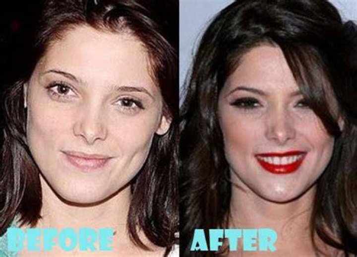 Ashley Greene Plastic Surgery Before and After