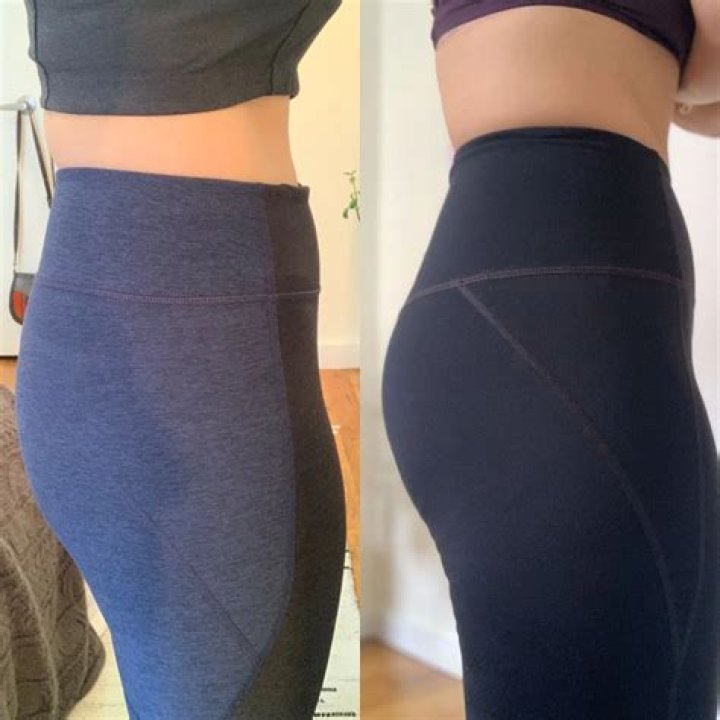 Kenya Moore Buttock Implants Plastic Surgery Before and After