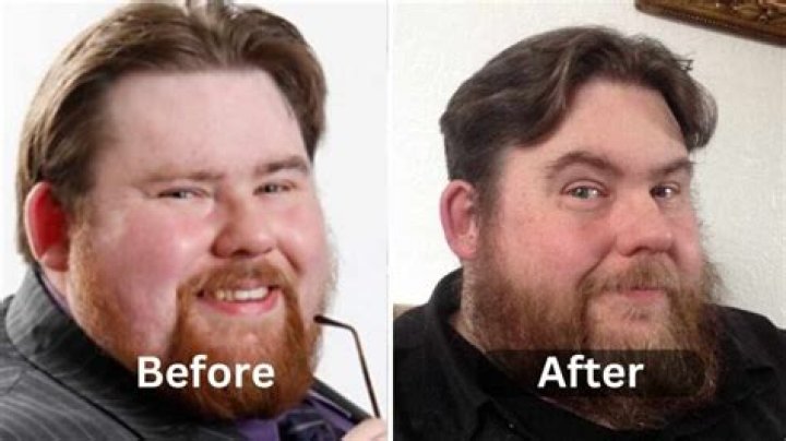 Michael Baggott Weight Loss: His weight loss Journey